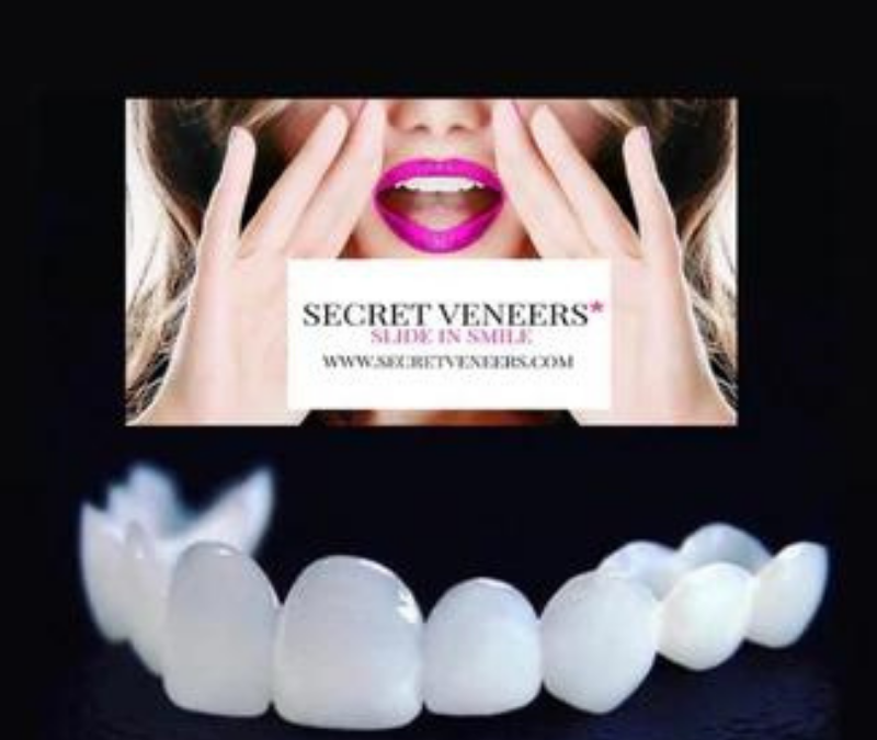 Secret Veneers Reviews: All you need to know